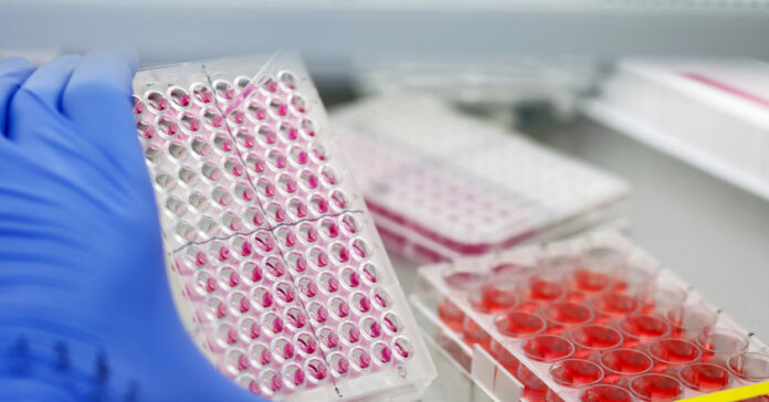New COVID-19 antibody test may reflect virus immunity more accurately